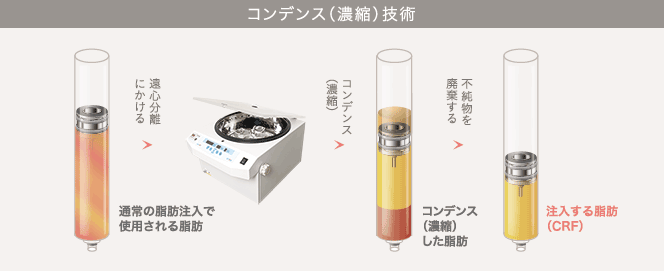 コンデンス（濃縮）技術の仕組み