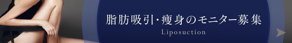 脂肪吸引のモニター募集