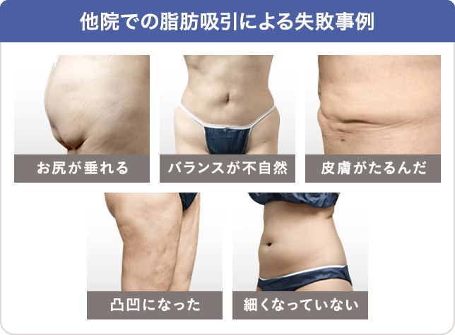 名古屋で脂肪吸引といえばザクリニック｜美容外科・形成外科